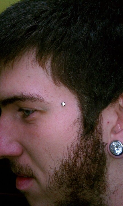 Surface anchor near eyebrow with gauge lobe